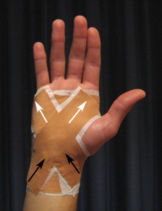 Two Ways to Tape the Wrist: Rigid Tape and Kinesiology Tape